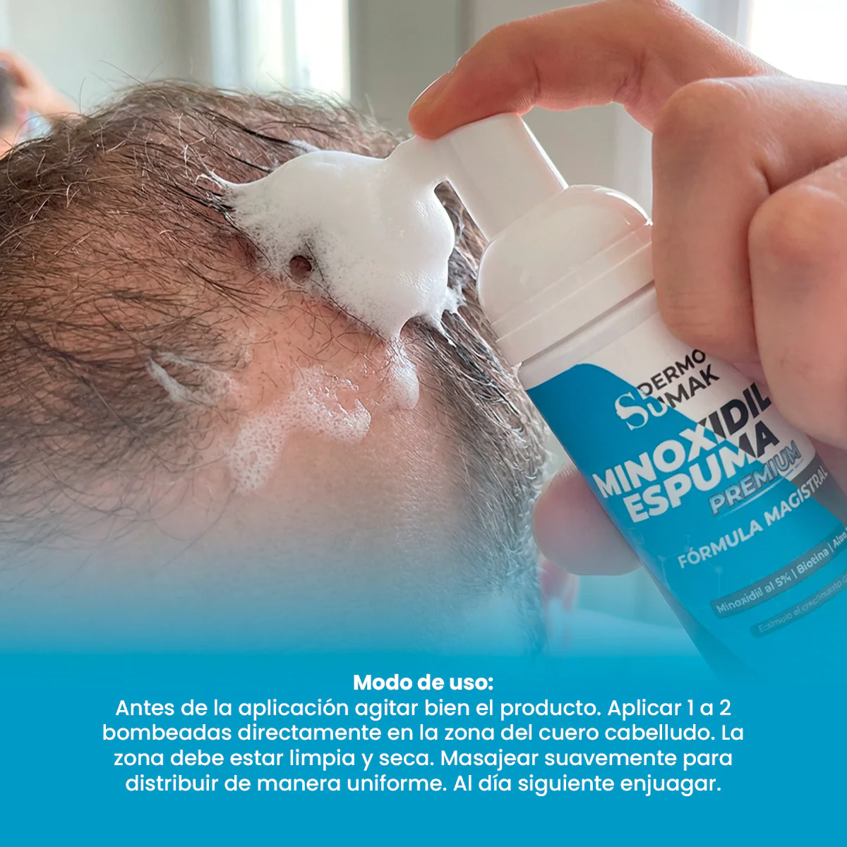 Minoxidil en espuma 5% 60ml - Dermo Sumak - Image 3